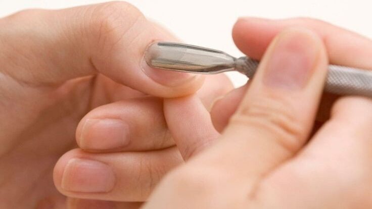 Os cuidados essenciais para ter unhas saudáveis e bonitas 5 91083d0a9e18da8eccf7af6eba234ec7 edited