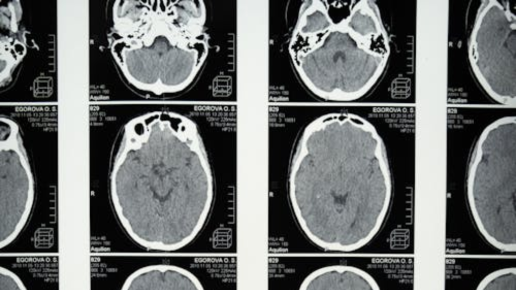 Descoberta na ciência: Estudo revela que neurônios têm a capacidade de mudar de tipo 1 Descoberta na ciência: Estudo revela que neurônios têm a capacidade de mudar de tipo