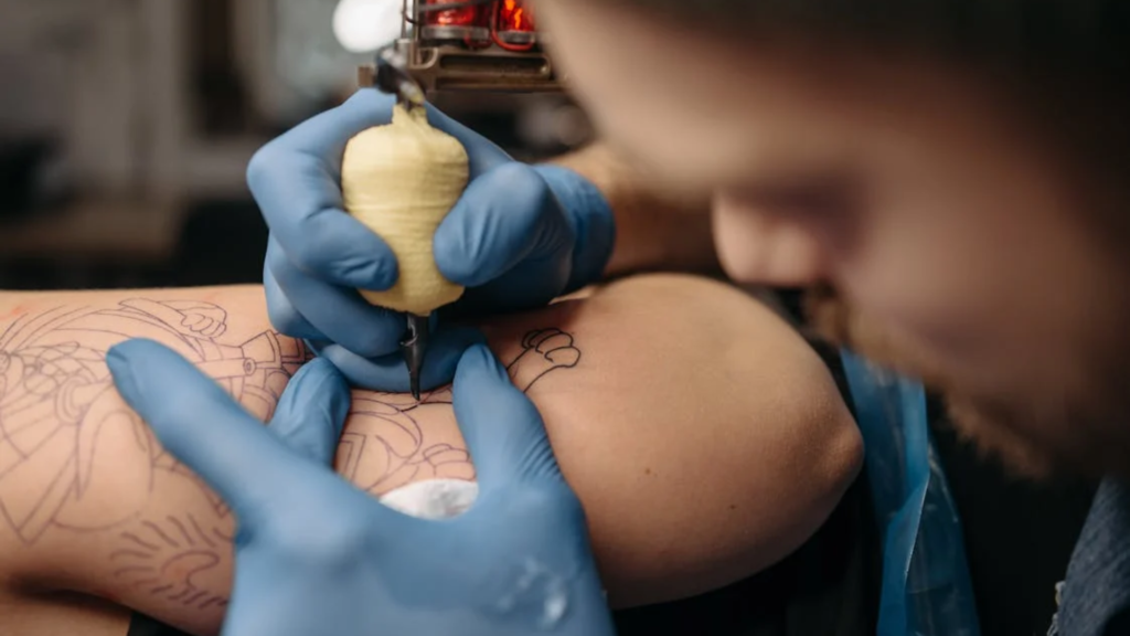 Apagar o passado? Remoção de tatuagens é mais frequente 1 remoção de tatuagens